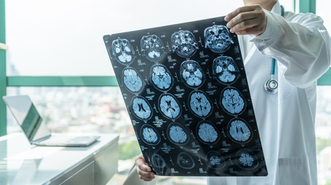 Beyin sağlığınız için mutlaka yapın!