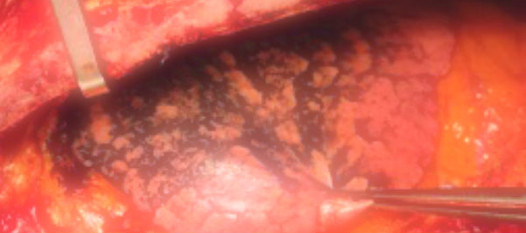 Sigarayı Hala Bırakmadıysanız Bu Yazıyı İyi Okuyun resim: 0