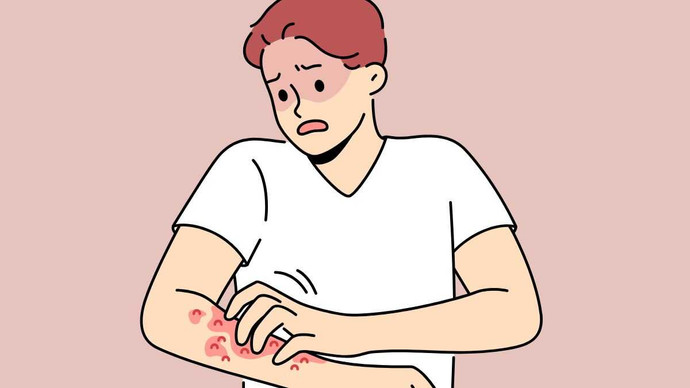 Yakında o hastalık için siz de hastaneye gidebilirsiniz! Yeni bir pandemi kapıda! resim: 0