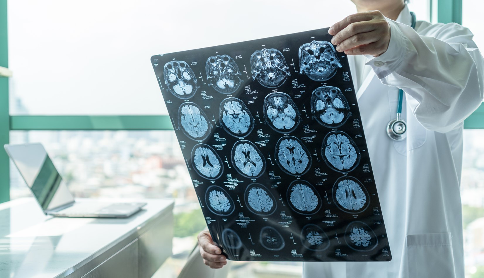 Beyin sağlığınız için mutlaka yapın!