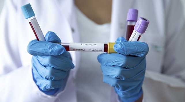 DSÖ'den 'Covid-19 tehdidi devam ediyor' uyarısı