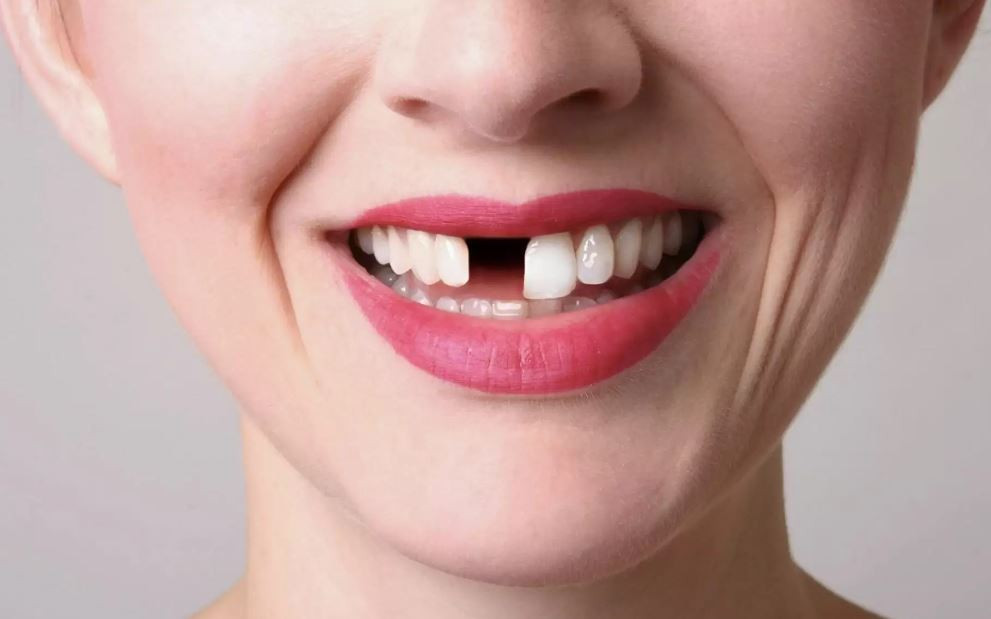 Dişsiz kalmak tarihe karışabilir: Bilim insanları duyurdu
